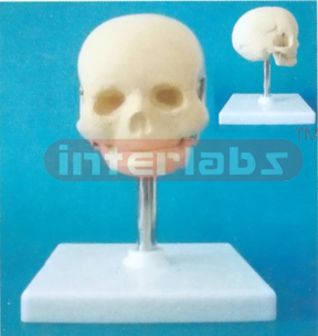 FETAL SKULL